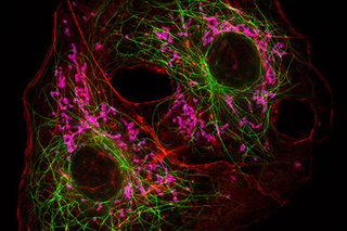super resolution micorscopy image of two cells showing microtubules and other stuff